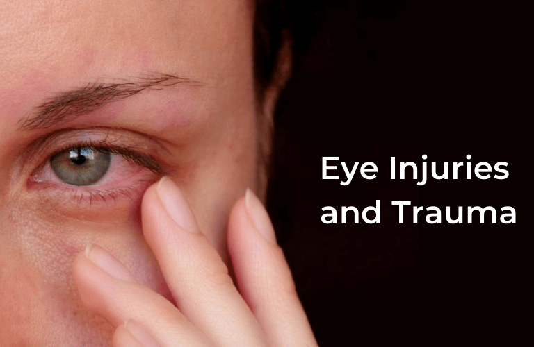 Eye Injuries and Trauma